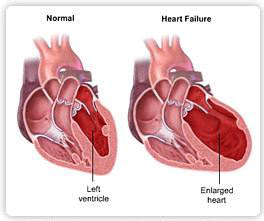 What Types Of Food Can Cause Heart Disease What Types Of Food Can Cause Heart Disease